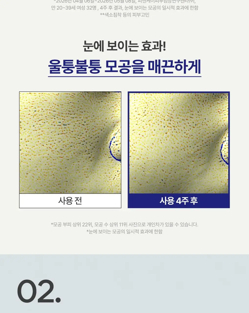 [UPGRADE] 이니스프리 레티놀 시카 모공 흔적 크림 50ml 기획(+30ml) 상세페이지 11